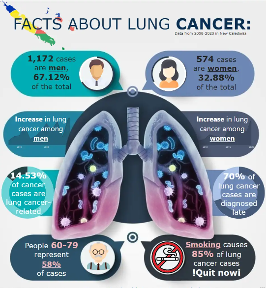 Facts about lung cancer